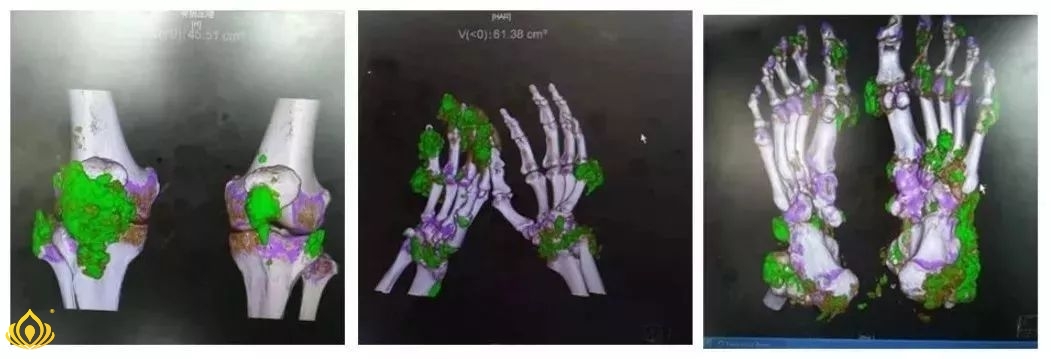 640?wx_fmt=jpeg.jpg